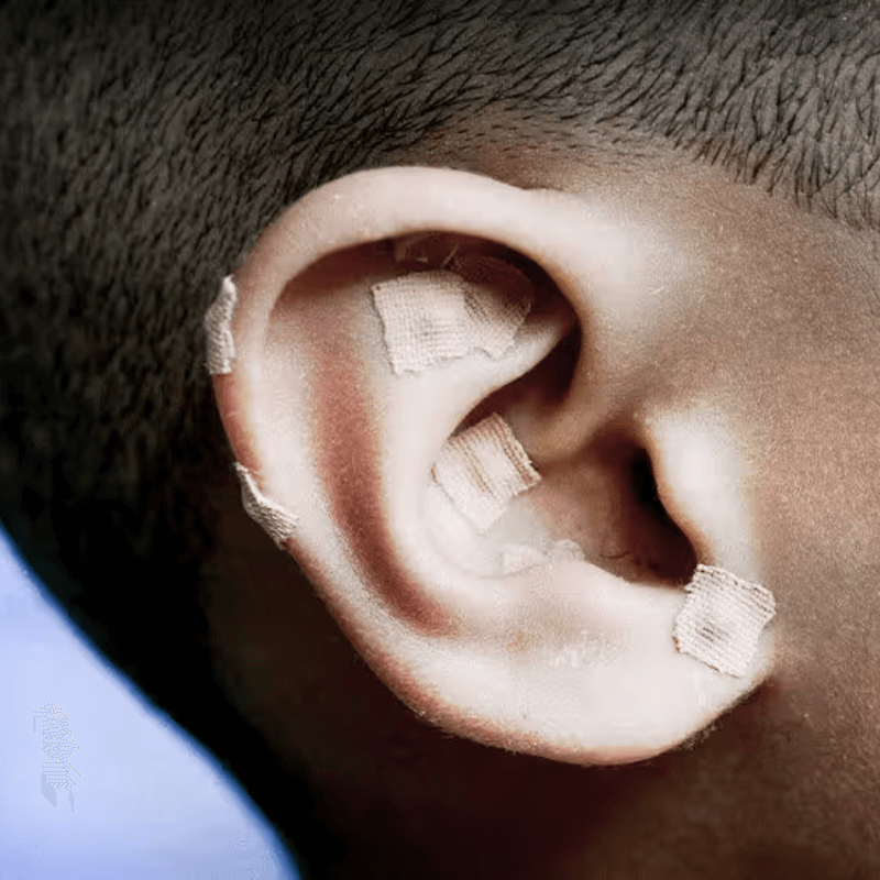 TheDivinePoint™ Ear Seed Stickers (720 pcs)